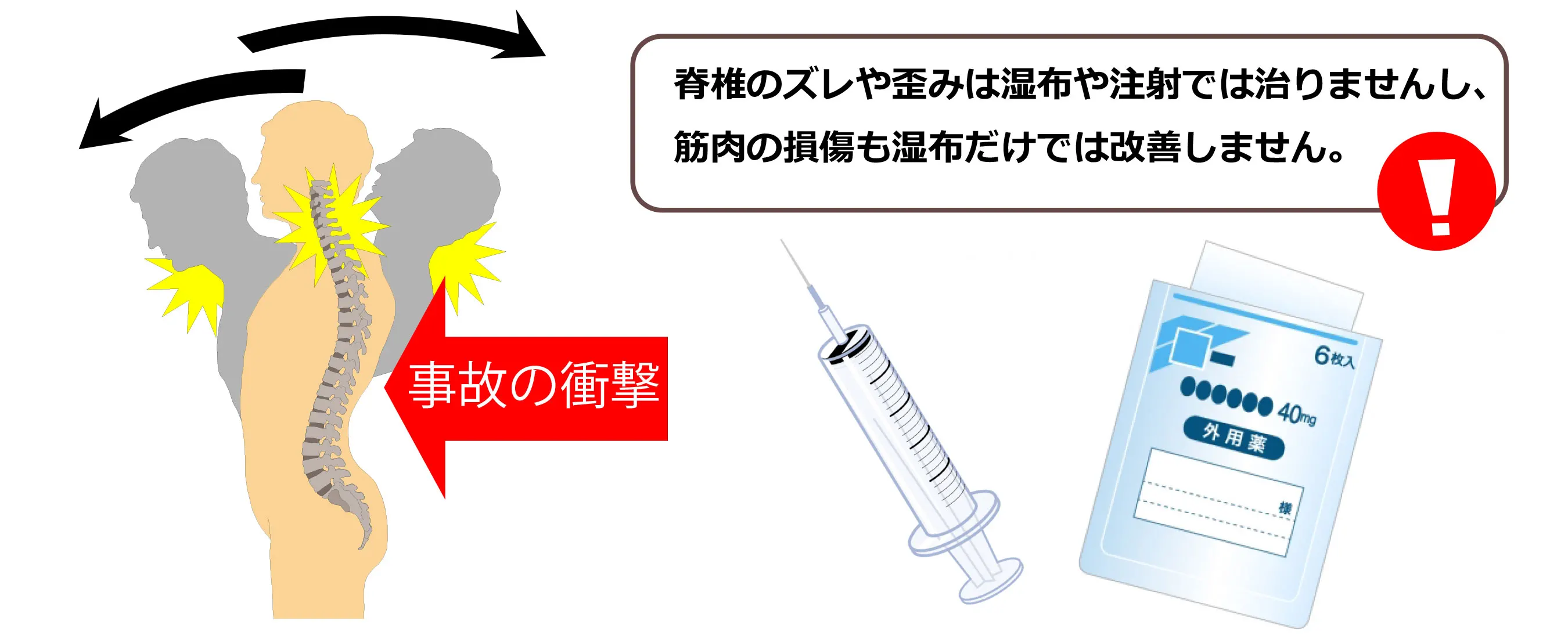 事故の衝撃